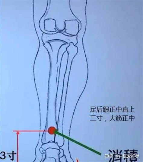 消積穴|四花下穴 